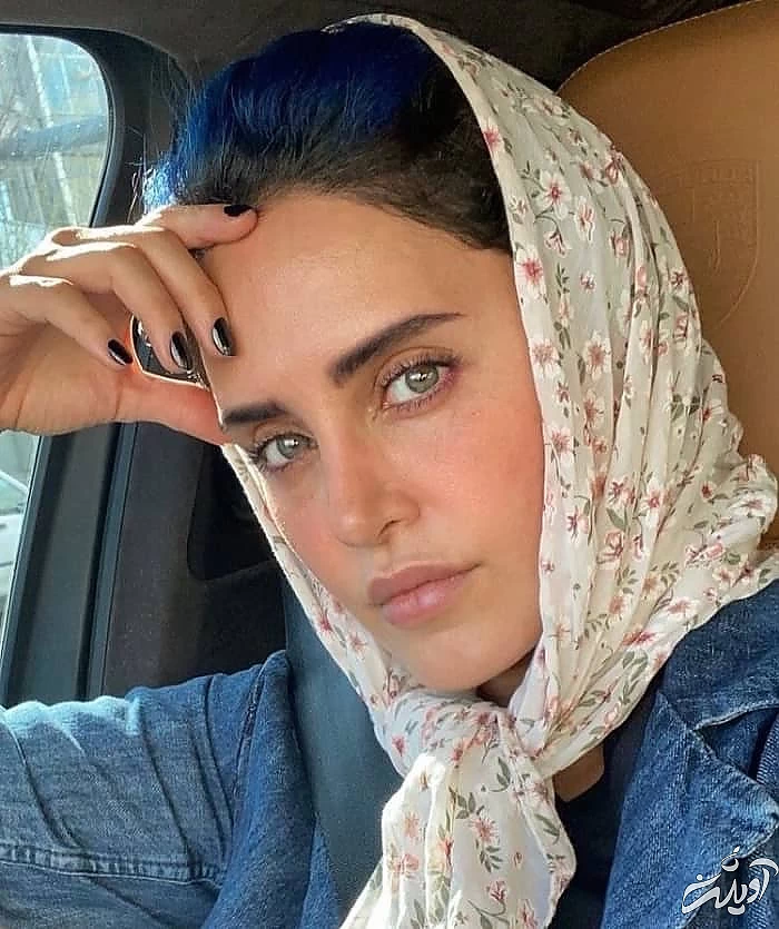 جراحی بینی الناز شاکر دوست عمل بینی